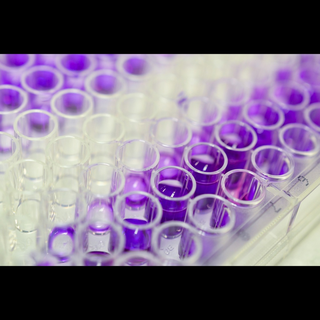 Fish immunoglobulin M  IgM  ELISA Kit size: 96 Tests